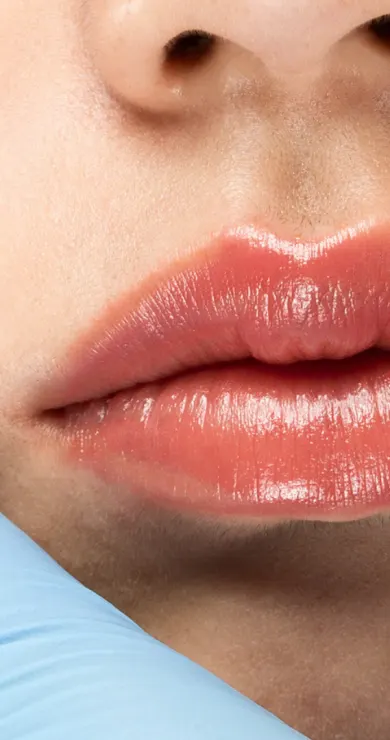 Carousel Slide Image of Botox-Prozess: Kurpfuscherin vor Gericht